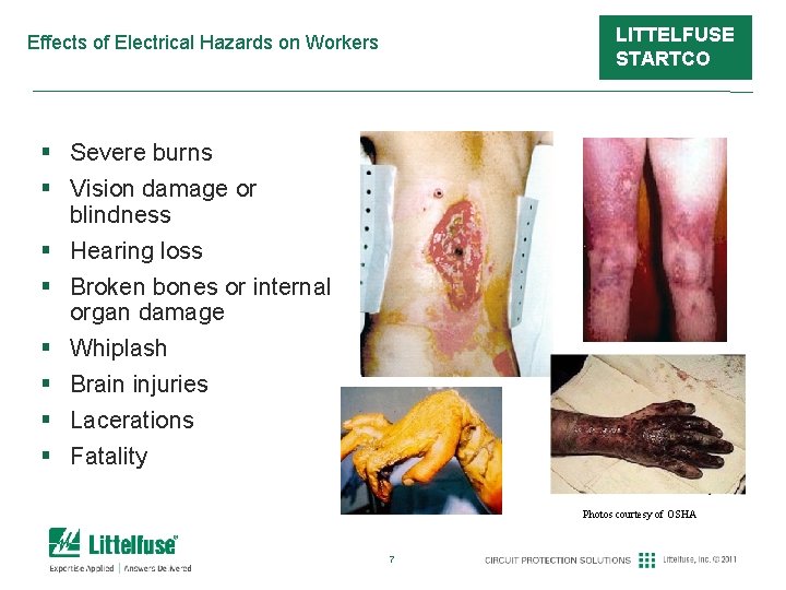 LITTELFUSE STARTCO Effects of Electrical Hazards on Workers § Severe burns § Vision damage