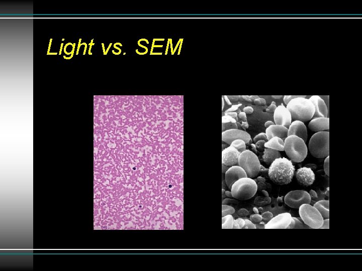 Light vs. SEM Light vs. SEM