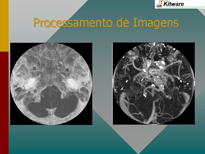 Processamento de Imagens 