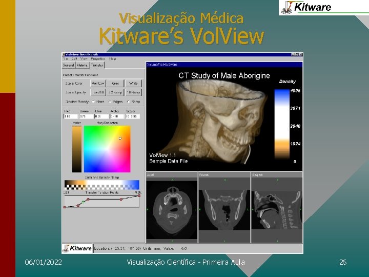 Visualização Médica Kitware’s Vol. View 06/01/2022 Visualização Científica - Primeira Aula 26 