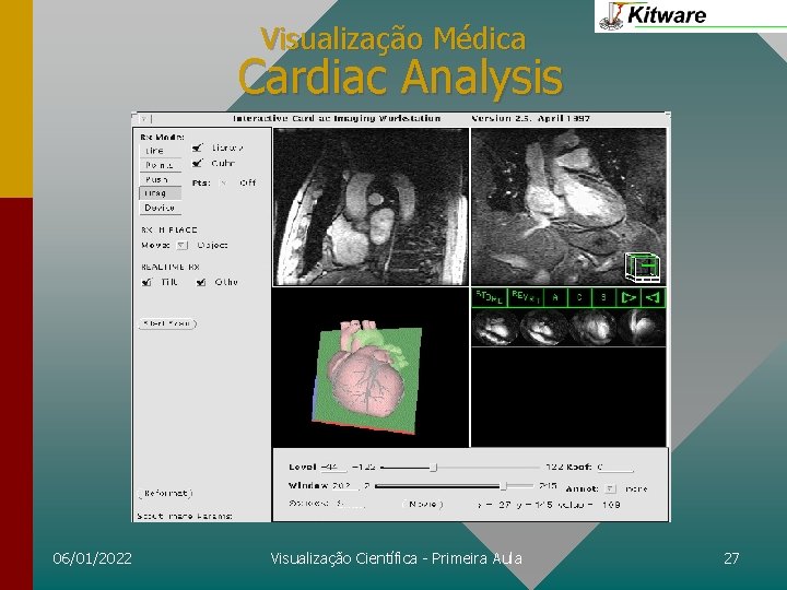 Visualização Médica Cardiac Analysis 06/01/2022 Visualização Científica - Primeira Aula 27 