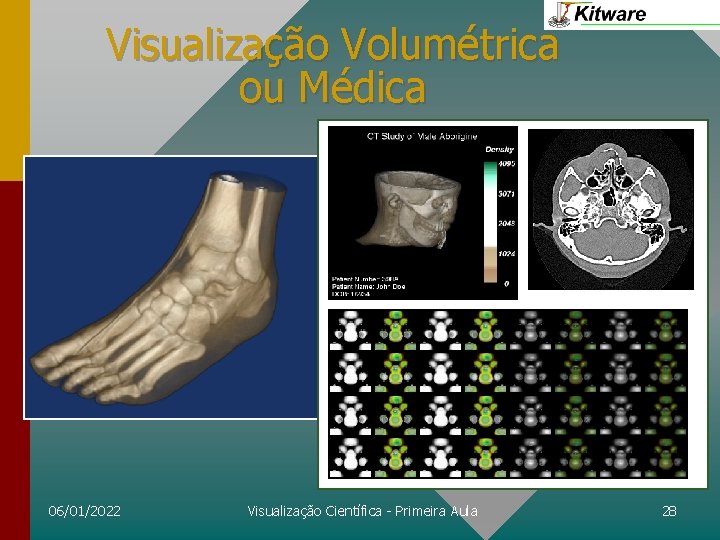 Visualização Volumétrica ou Médica 06/01/2022 Visualização Científica - Primeira Aula 28 