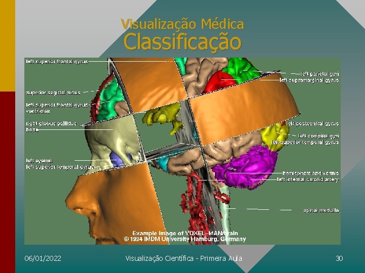 Visualização Médica Classificação 06/01/2022 Visualização Científica - Primeira Aula 30 