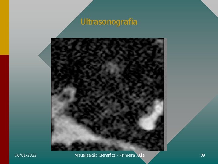 Ultrasonografia 06/01/2022 Visualização Científica - Primeira Aula 39 