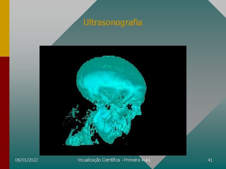 Ultrasonografia 06/01/2022 Visualização Científica - Primeira Aula 41 