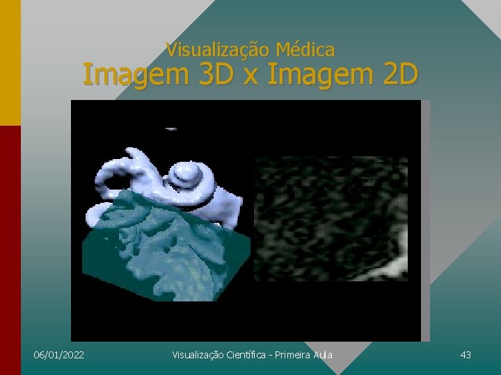 Visualização Médica Imagem 3 D x Imagem 2 D 06/01/2022 Visualização Científica - Primeira
