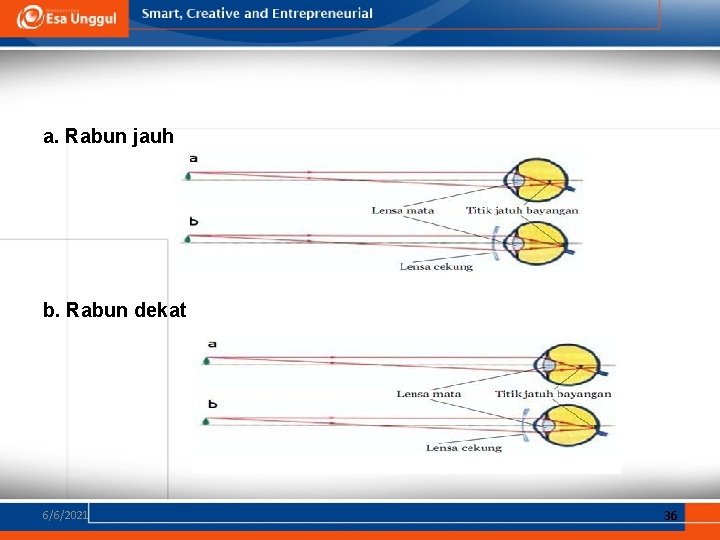 a. Rabun jauh b. Rabun dekat 6/6/2021 36 