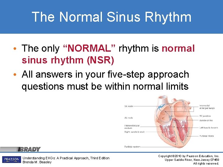 The Normal Sinus Rhythm • The only “NORMAL” rhythm is normal sinus rhythm (NSR)