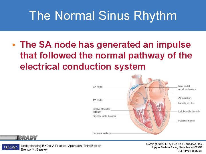 The Normal Sinus Rhythm • The SA node has generated an impulse that followed