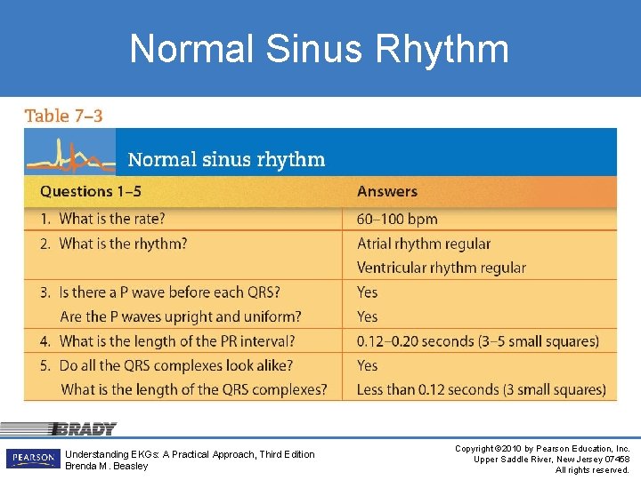 Normal Sinus Rhythm Understanding EKGs: A Practical Approach, Third Edition Brenda M. Beasley Copyright