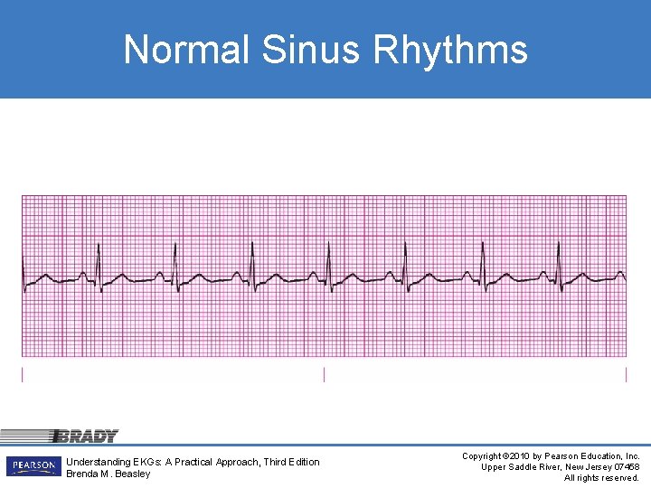 Normal Sinus Rhythms Understanding EKGs: A Practical Approach, Third Edition Brenda M. Beasley Copyright