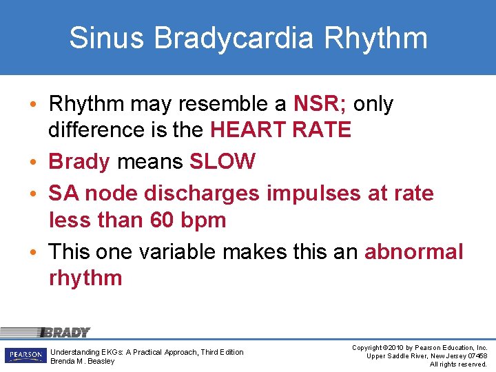 Sinus Bradycardia Rhythm • Rhythm may resemble a NSR; only difference is the HEART