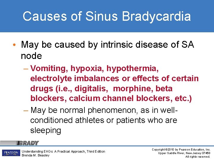 Causes of Sinus Bradycardia • May be caused by intrinsic disease of SA node