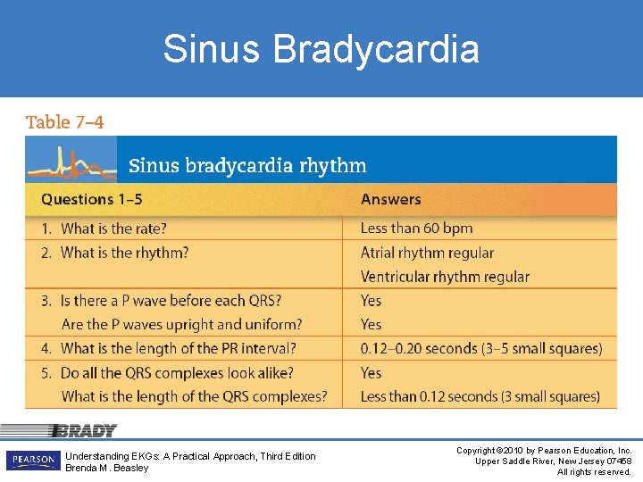 Sinus Bradycardia Understanding EKGs: A Practical Approach, Third Edition Brenda M. Beasley Copyright ©