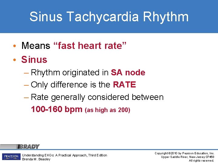Sinus Tachycardia Rhythm • Means “fast heart rate” • Sinus – Rhythm originated in