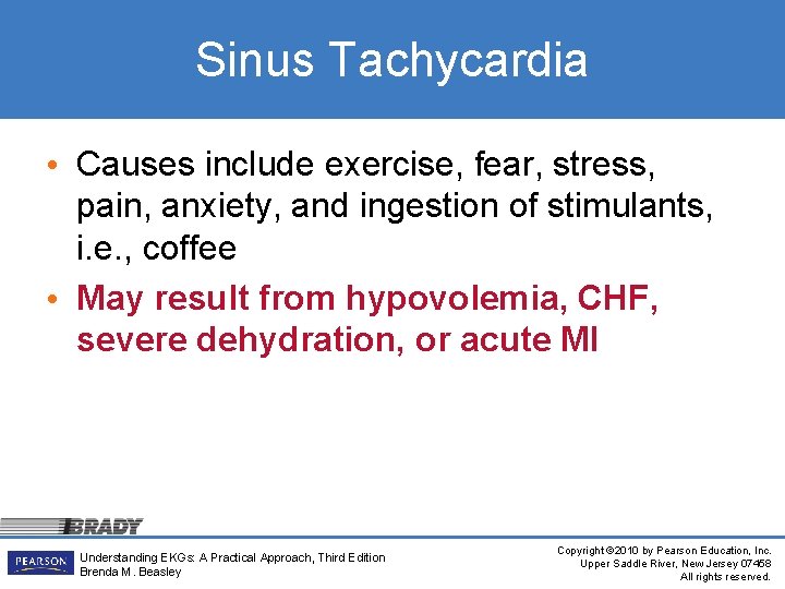 Sinus Tachycardia • Causes include exercise, fear, stress, pain, anxiety, and ingestion of stimulants,