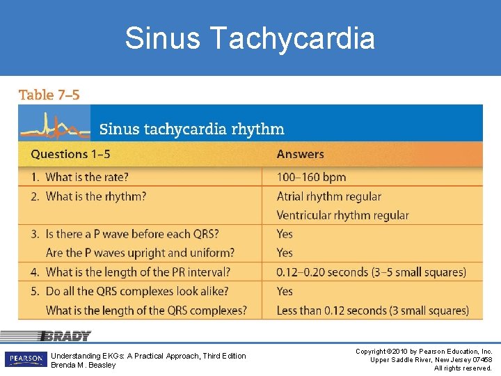 Sinus Tachycardia Understanding EKGs: A Practical Approach, Third Edition Brenda M. Beasley Copyright ©