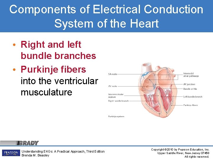 Components of Electrical Conduction System of the Heart • Right and left bundle branches