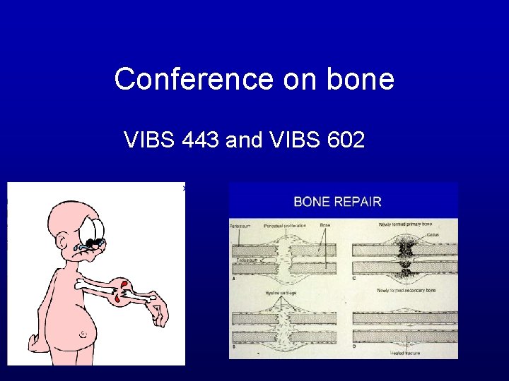 Conference on bone VIBS 443 and VIBS 602 