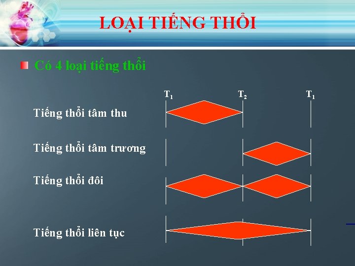 LOẠI TIẾNG THỔI Có 4 loại tiếng thổi T 1 Tiếng thổi tâm thu