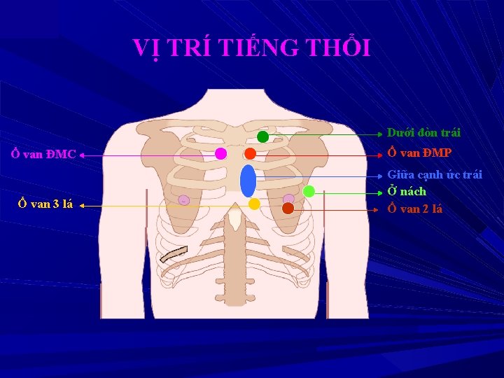 VỊ TRÍ TIẾNG THỔI Dưới đòn trái Ổ van ĐMC Ổ van 3 lá