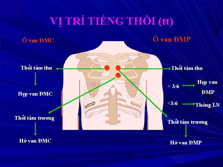 VỊ TRÍ TIẾNG THỔI (tt) Ổ van ĐMC Thổi tâm thu Ổ van ĐMP