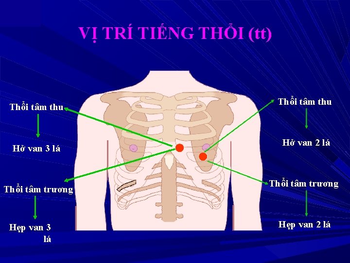 VỊ TRÍ TIẾNG THỔI (tt) Thổi tâm thu Hở van 3 lá Thổi tâm