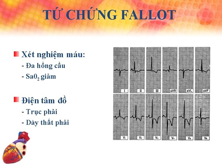 TỨ CHỨNG FALLOT Xét nghiệm máu: - Đa hồng cầu - Sa 02 giảm