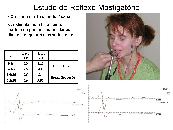 Estudo do Reflexo Mastigatório • O estudo é feito usando 2 canais • A