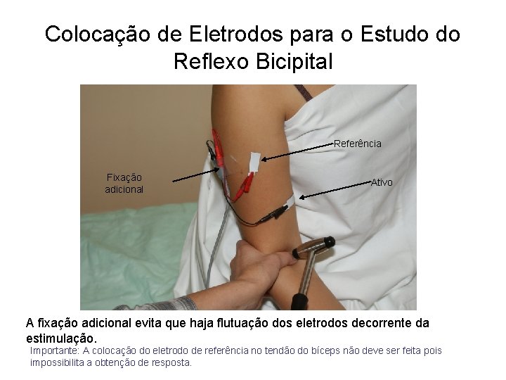 Colocação de Eletrodos para o Estudo do Reflexo Bicipital Referência Fixação adicional Ativo A