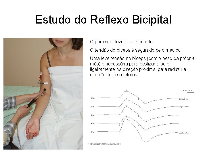 Estudo do Reflexo Bicipital O paciente deve estar sentado. O tendão do bíceps é