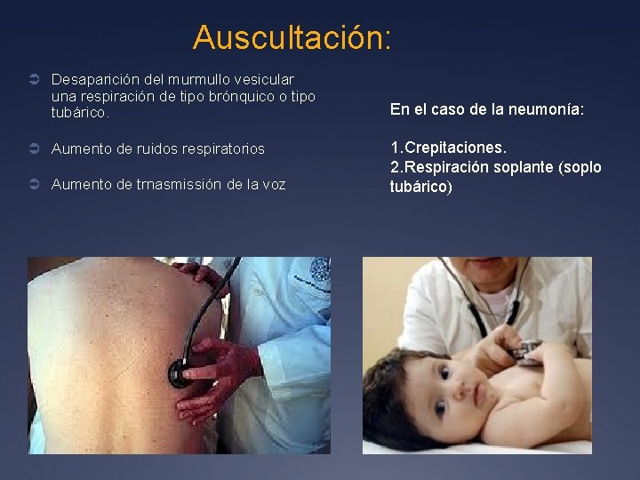 Auscultación: Ü Desaparición del murmullo vesicular una respiración de tipo brónquico o tipo tubárico.