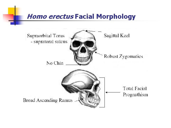 Homo erectus Facial Morphology 