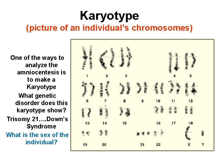 Karyotype (picture of an individual’s chromosomes) One of the ways to analyze the amniocentesis Karyotype (picture of an individual’s chromosomes) One of the ways to analyze the amniocentesis