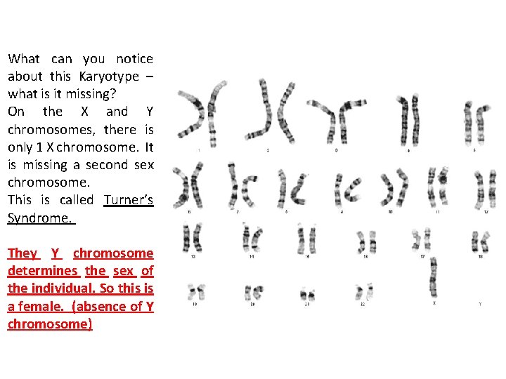 What can you notice about this Karyotype – what is it missing? On the What can you notice about this Karyotype – what is it missing? On the