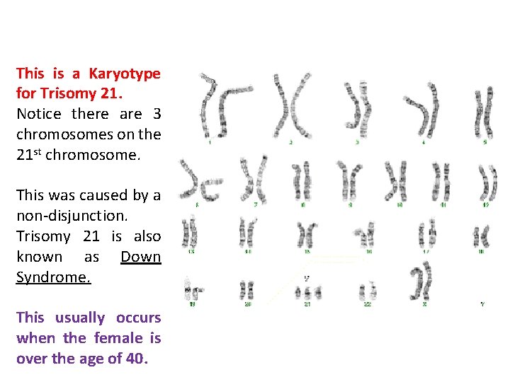 This is a Karyotype for Trisomy 21. Notice there are 3 chromosomes on the This is a Karyotype for Trisomy 21. Notice there are 3 chromosomes on the