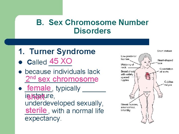 B. Sex Chromosome Number Disorders 1. Turner Syndrome 45 XO l Called ______ l