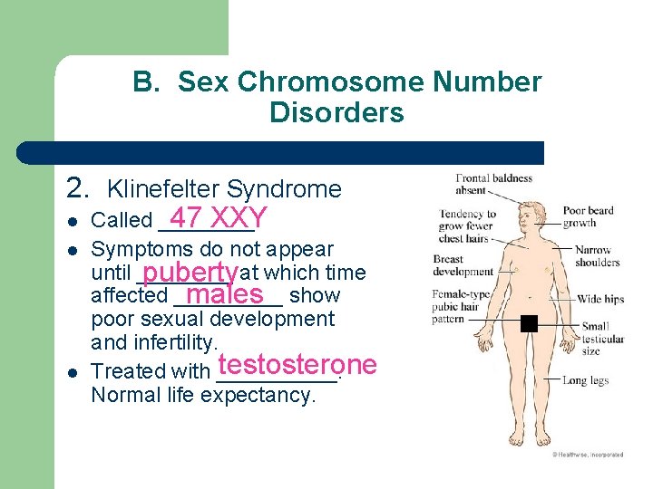 B. Sex Chromosome Number Disorders 2. Klinefelter Syndrome 47 XXY l Called ____. l