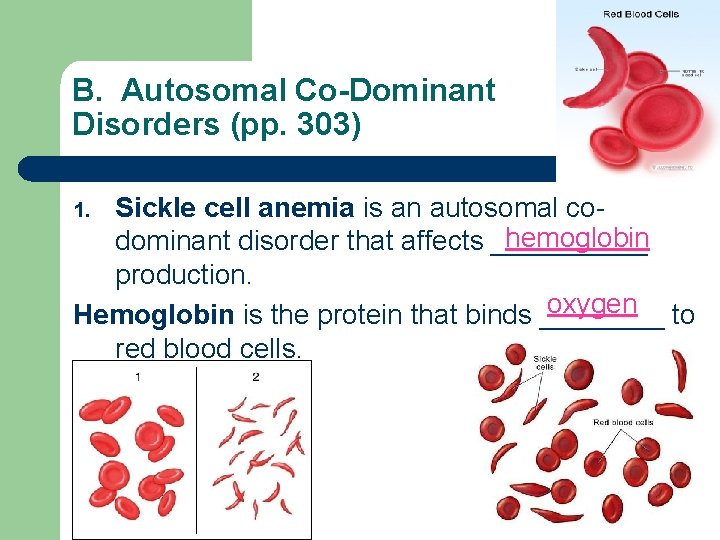 B. Autosomal Co-Dominant Disorders (pp. 303) Sickle cell anemia is an autosomal cohemoglobin dominant