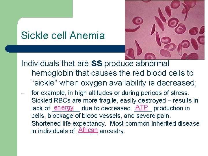 Sickle cell Anemia Individuals that are SS produce abnormal hemoglobin that causes the red
