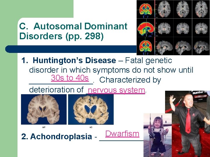 C. Autosomal Dominant Disorders (pp. 298) 1. Huntington’s Disease – Fatal genetic disorder in