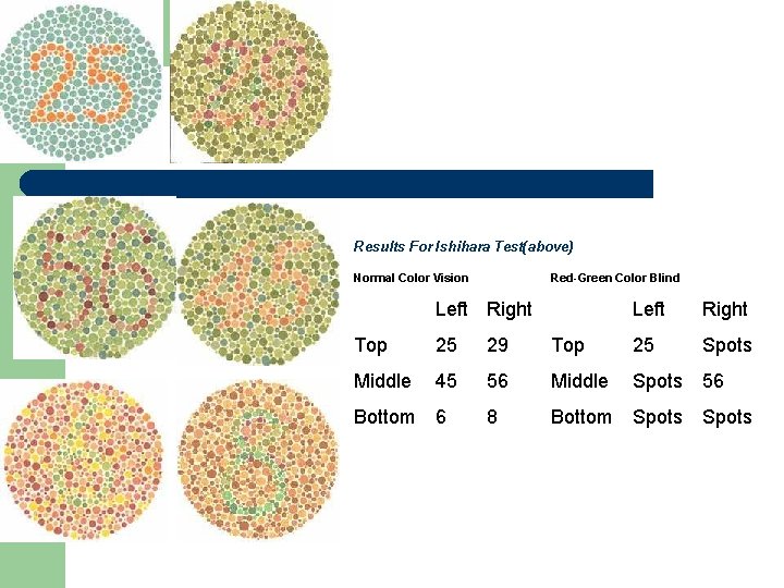 Results For Ishihara Test(above) Normal Color Vision Red-Green Color Blind Left Right Spots Top