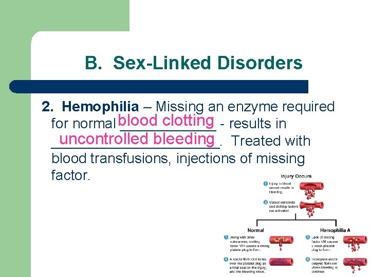 B. Sex-Linked Disorders 2. Hemophilia – Missing an enzyme required clotting - results in