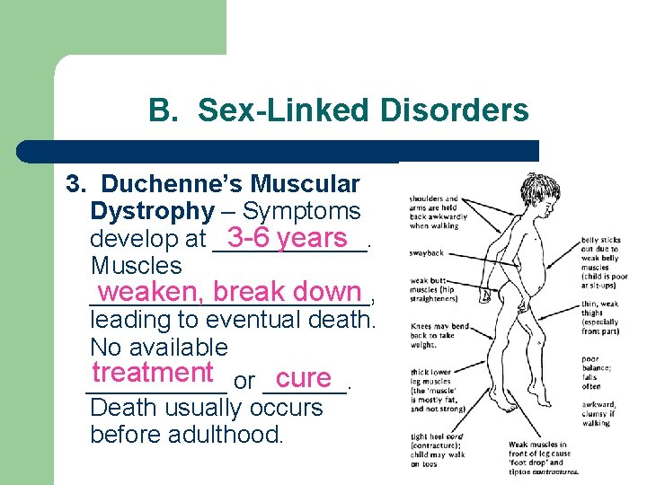 B. Sex-Linked Disorders 3. Duchenne’s Muscular Dystrophy – Symptoms develop at ______. 3 -6