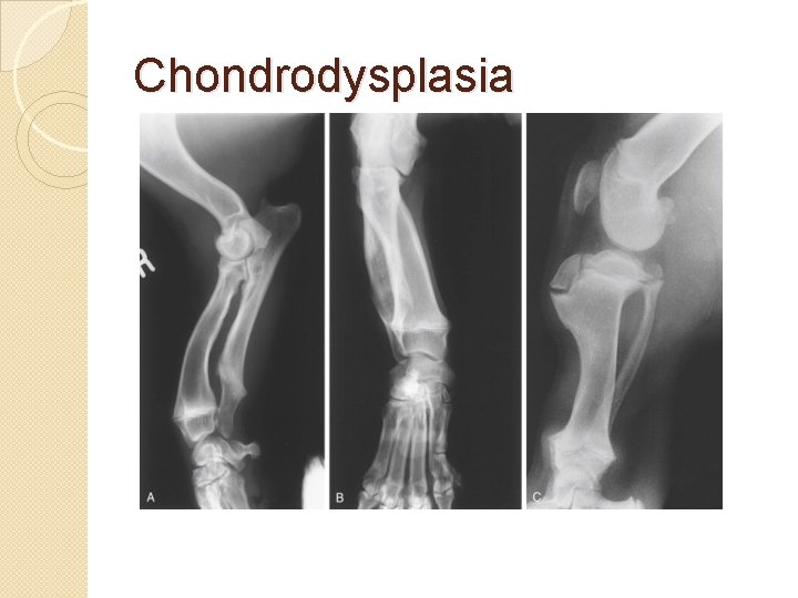 Chondrodysplasia 