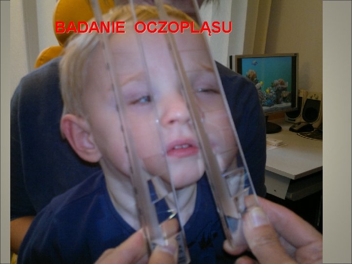 BADANIE OCZOPLĄSU 
