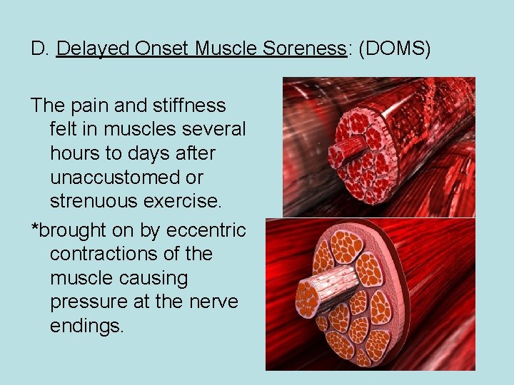 D. Delayed Onset Muscle Soreness: (DOMS) The pain and stiffness felt in muscles several