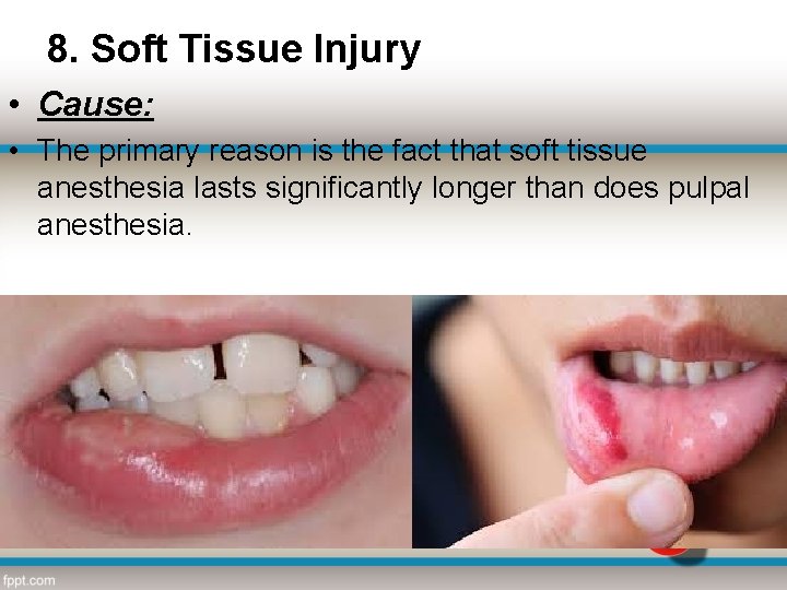 8. Soft Tissue Injury • Cause: • The primary reason is the fact that