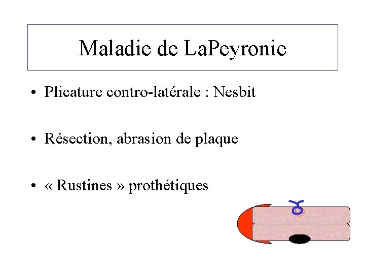 Maladie de La. Peyronie • Plicature contro-latérale : Nesbit • Résection, abrasion de plaque