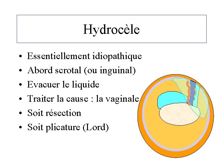 Hydrocèle • • • Essentiellement idiopathique Abord scrotal (ou inguinal) Evacuer le liquide Traiter